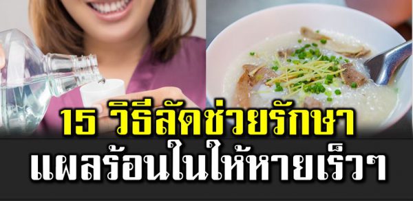 15 วิ ธีลั ดช่วยรักษาแผ ลร้อนในให้หายเร็วๆ