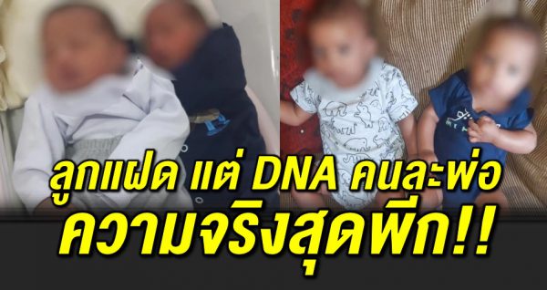 คลอดลูกแฝด แต่ผล DNA ออกมาคนละพ่อ